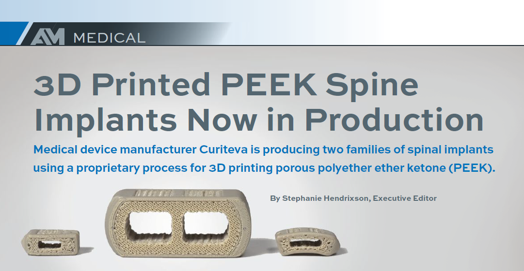 Implants Now in Production - AM Additive Manufacturing Magazine